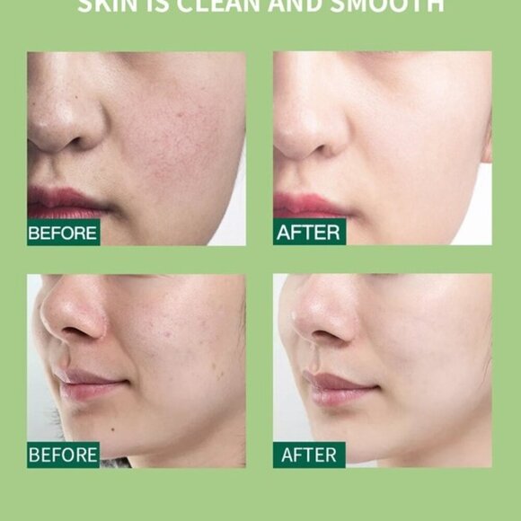 5 Travel Size Deep Cleansing Facial Clay Mask Pods (50 Capsules) - Picture 4 of 6